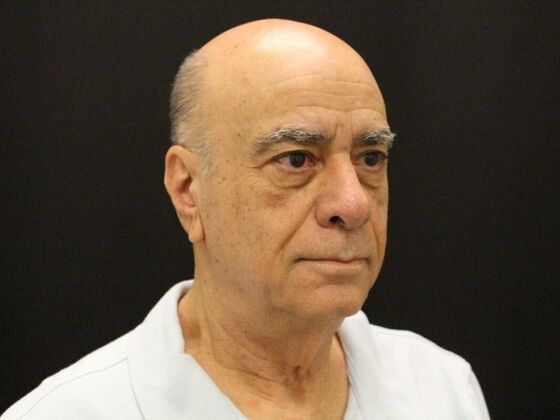 Face & Neck Lifts: Case 6 - Before