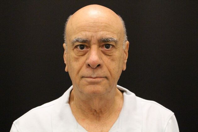 Face & Neck Lifts: Case 6 - Before