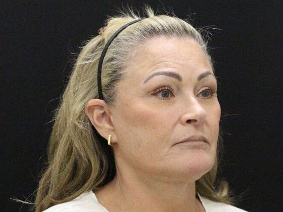 Face & Neck Lifts: Case 51 - After