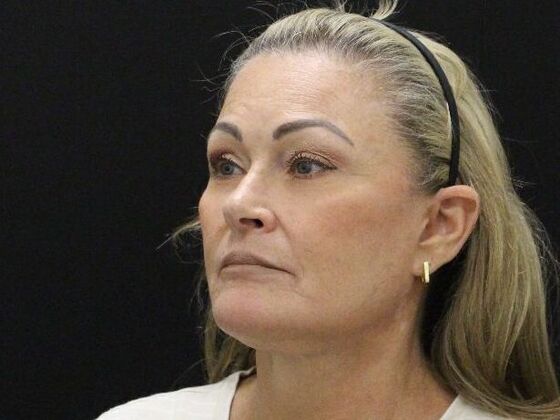 Face & Neck Lifts: Case 51 - After