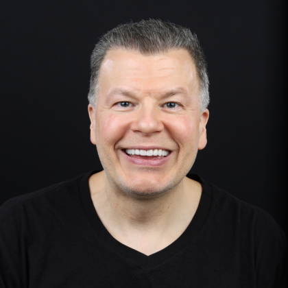 Minimal Prep Porcelain Veneers Luis - After