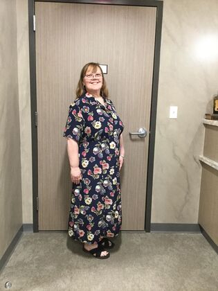 Gastric Sleeve: Case 13 - After