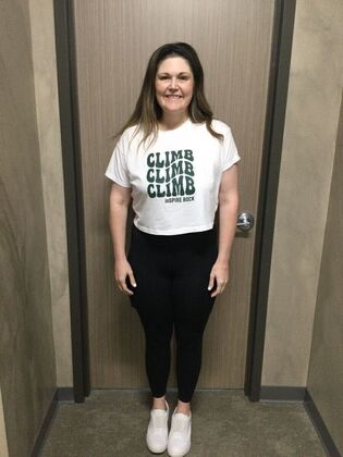 Gastric Sleeve Case 8 - After