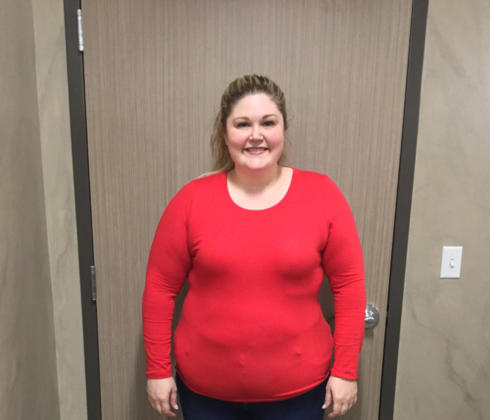 Gastric Sleeve Case 8 - Before