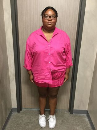 Gastric Sleeve Case 15 - Before