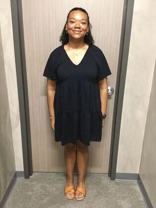 Gastric Sleeve Case 15 - After