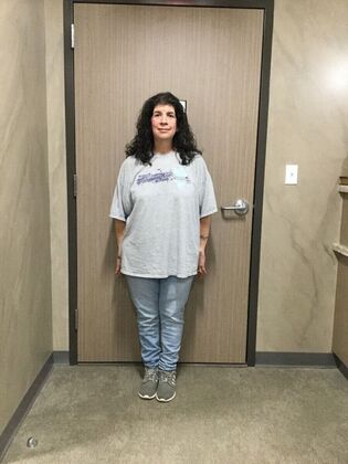 Duodenal Switch Case