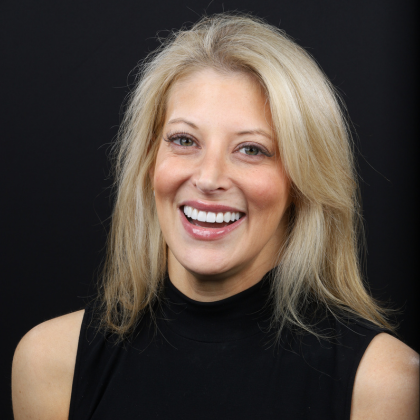 Minimal Prep Porcelain Veneers Cari - After