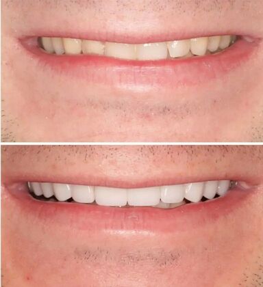 Smile Gallery  Case 19