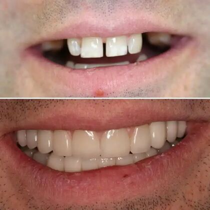 Smile Gallery  Case 27