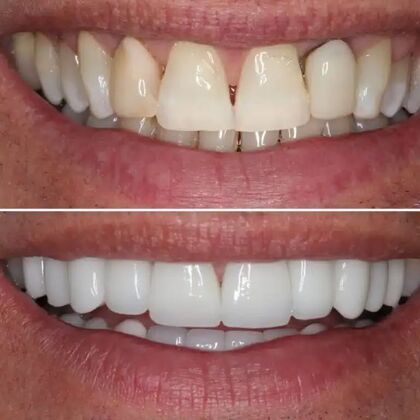 Smile Gallery  Case 29