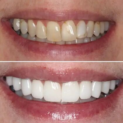 Smile Gallery  Case 36