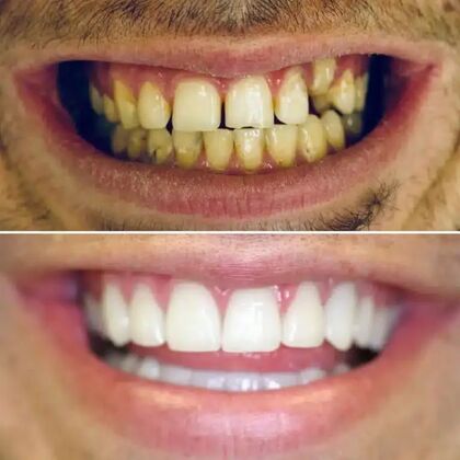 Smile Gallery  Case 37