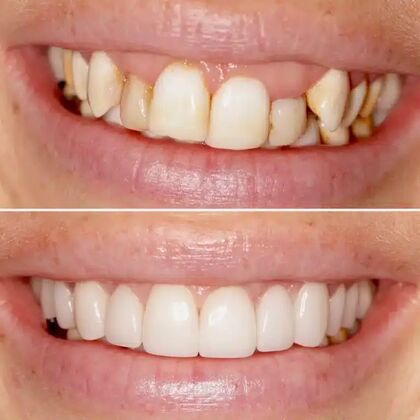 Smile Gallery  Case 44