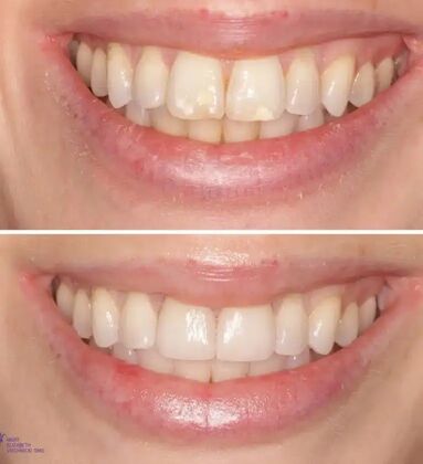 Smile Gallery  Case 53