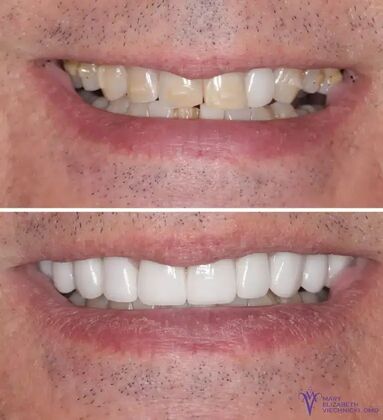 Smile Gallery  Case 57