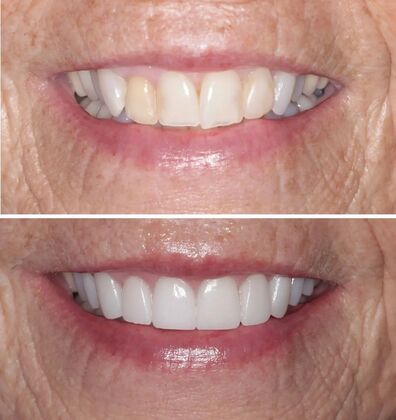 Smile Gallery  Case 59