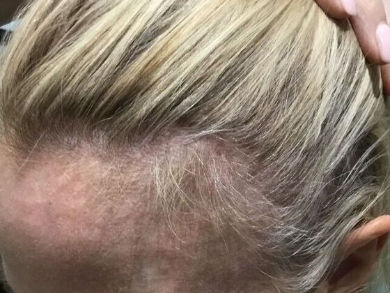 Advanced Non-Surgical Treatments Cases