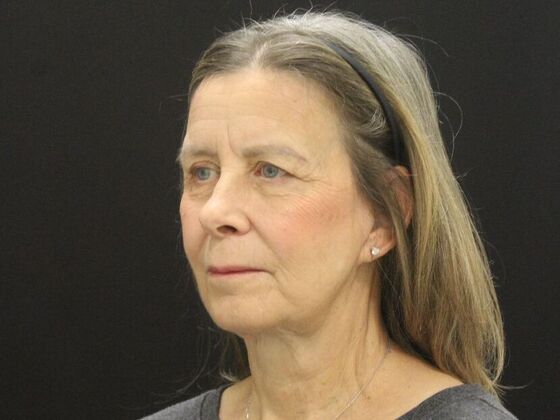 Face & Neck Lifts: Case 53 - After