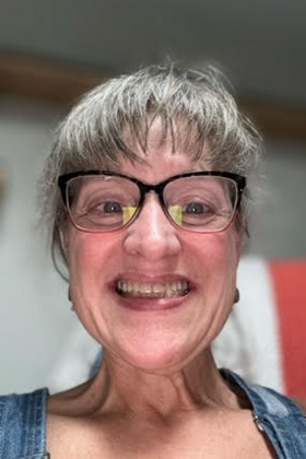 Smile Makeover Case 1 - Before