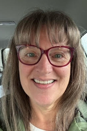 Smile Makeover Case 1 - After