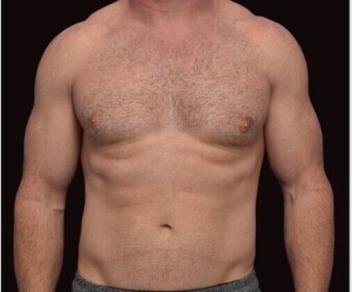 Male Procedures Case