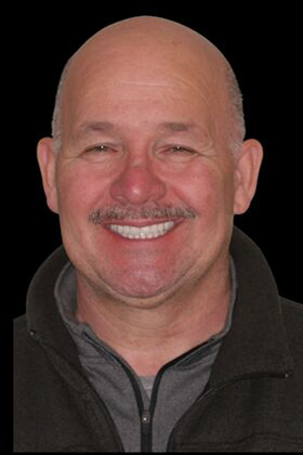 All-on-4 Dental Implants Cases