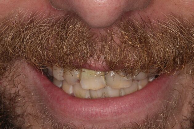 Before and Afters  Case 1 - Before