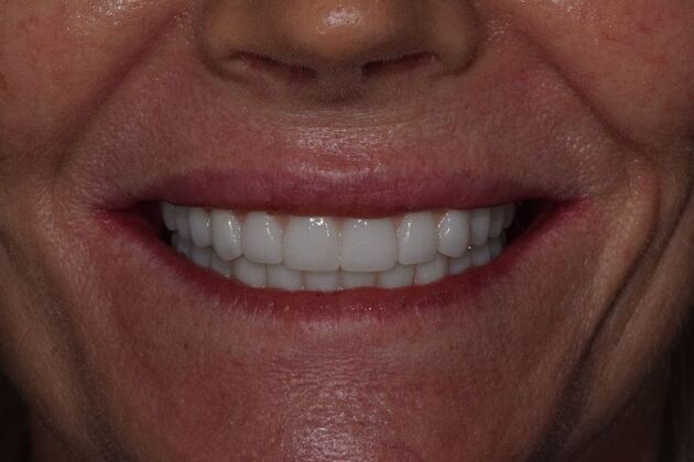 Before and Afters  Case 2 - After