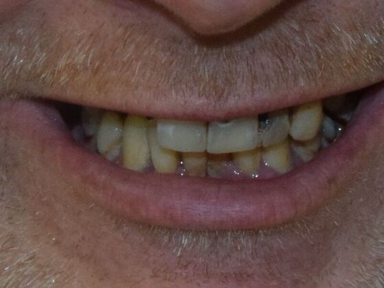 Before and Afters  Case 3 - Before