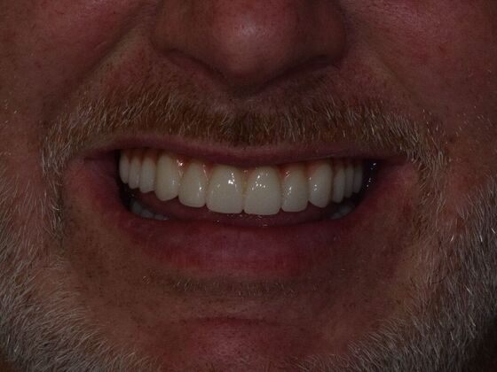 Before and Afters  Case 3 - After