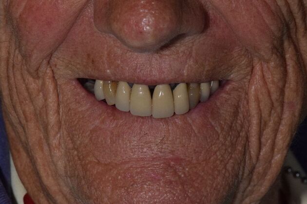 Before and Afters  Case 4 - Before