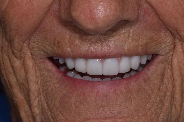 Before and Afters  Case 4 - After