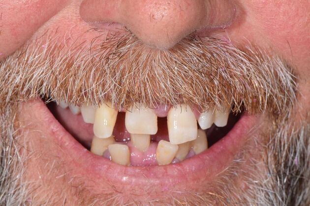 Before and Afters  Case 5 - Before