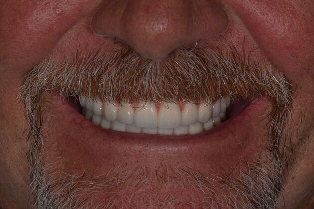 Before and Afters  Case 5 - After