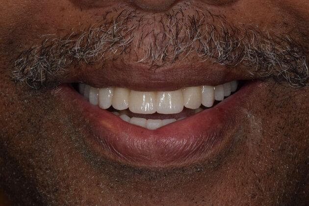 Before and Afters  Case 6 - After