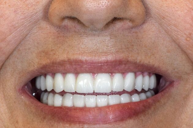 Before and Afters  Case 7 - After