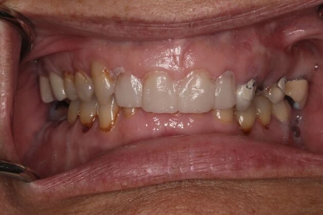 Before and Afters : Case 7 - Before