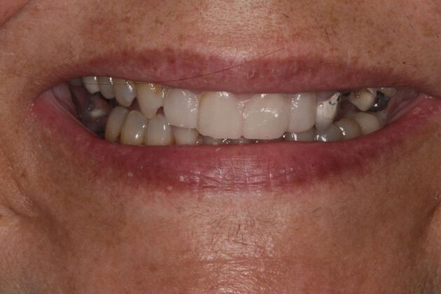 Before and Afters  Case 7 - Before