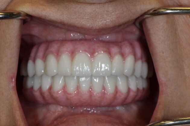 Before and Afters : Case 7 - After