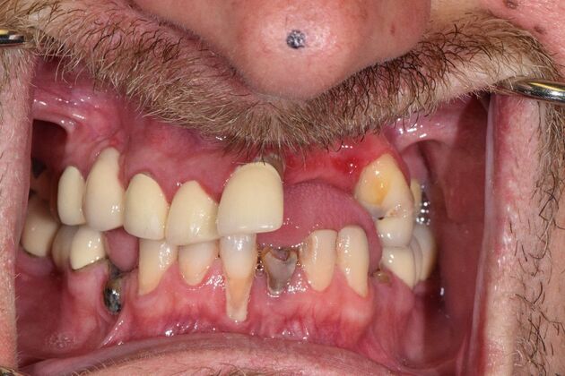 Before and Afters : Case 8 - Before