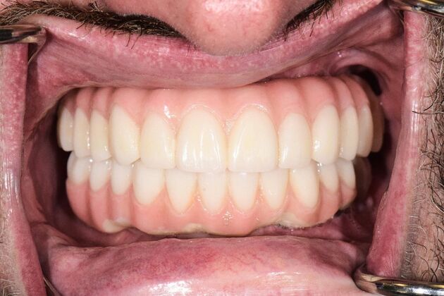 Before and Afters : Case 8 - After