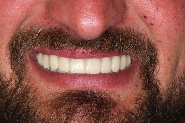 Before and Afters  Case 8 - After