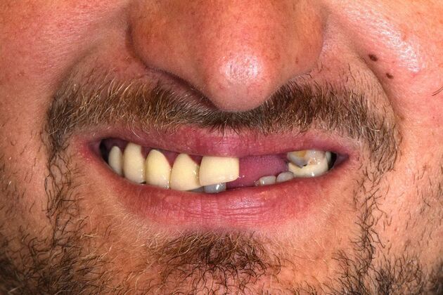 Before and Afters  Case 8 - Before