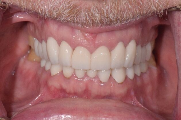 Before and Afters : Case 9 - After