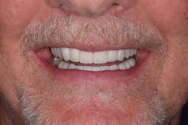 Before and Afters  Case 9 - After