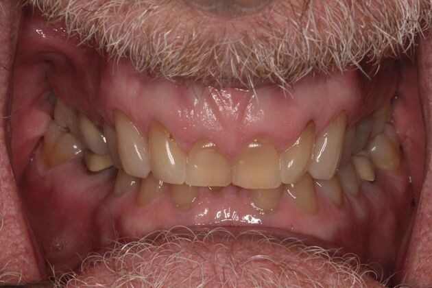 Before and Afters : Case 9 - Before