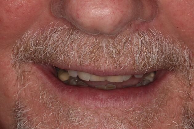 Before and Afters  Case 9 - Before