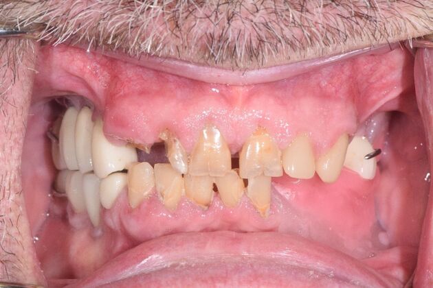 Before and Afters : Case 10 - Before