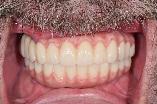 Before and Afters : Case 10 - After